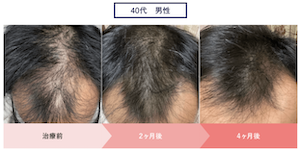 クリニックフォア症例