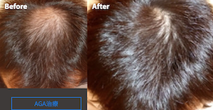 ゴリラクリニック症例