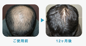 oops（ウープス）症例