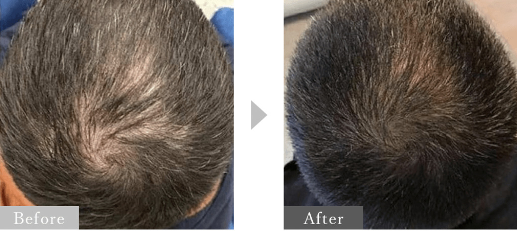 AGAライズクリニックの症例