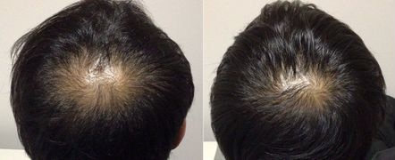 毛髪のクリニック症例写真